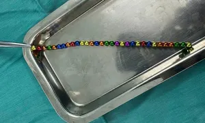 31 viên nam châm nhiều màu kết chuỗi trong ruột bé trai