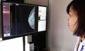 Bệnh nhân ung thư vú tăng gấp đôi sau 10 năm